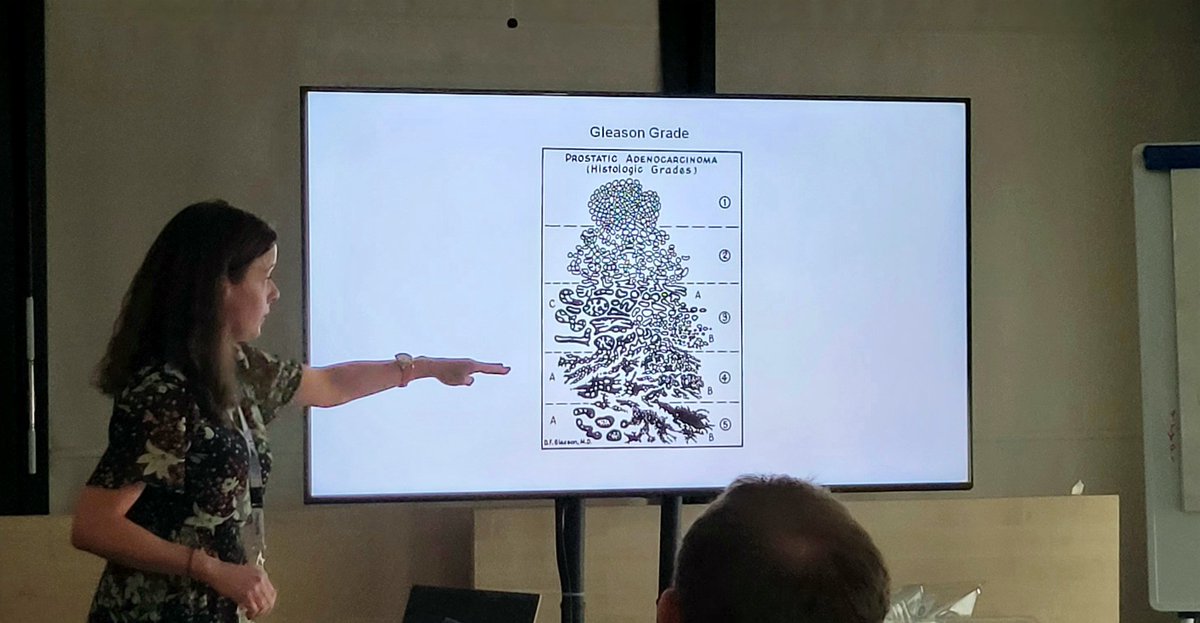 Today our lab was honored to be part of #WINGMEN day for patients. Feeling grateful for the opportunity to share our research. Huge thanks to Prof Val Macaulay and her team for organizing such an amazing event! #IGF1

@NDSurgicalSci
@ProstateUK