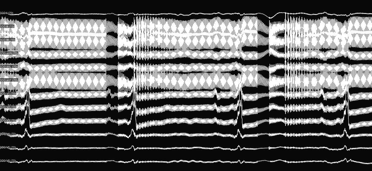 Chirag Barbhaiya tweet media