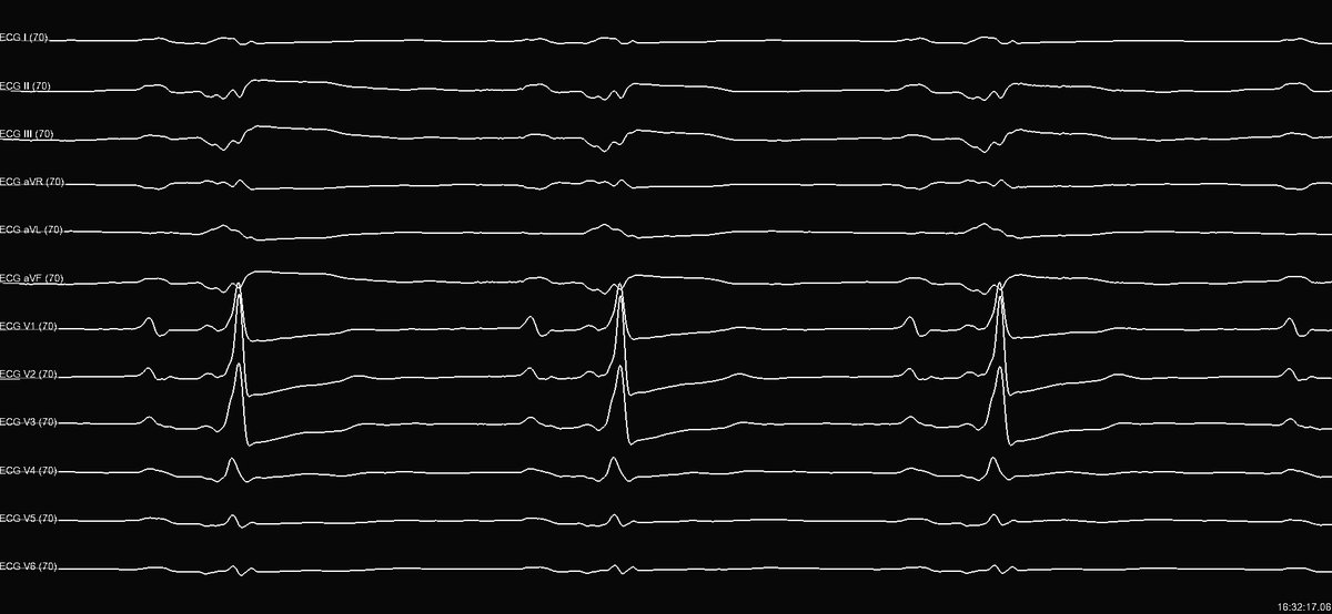 Chirag Barbhaiya tweet media