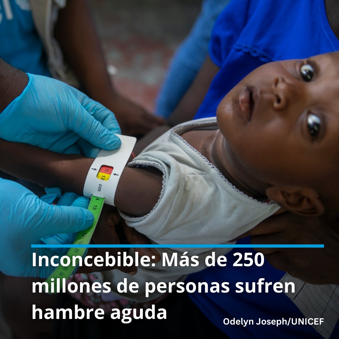 ONU_es's tweet photo. El número de personas que padecieron hambre aguda en 2022 es el más alto de los últimos 7 años.

250 millones de personas se encuentran en esa penosa situación y necesitan ayuda, según el informe mundial de la crisis alimentaria: https://t.co/Lu88hx4W0H https://t.co/CtafKZicXR