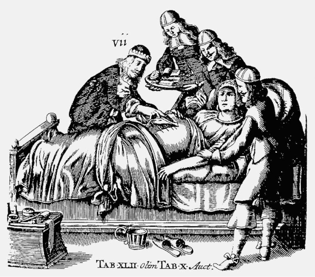 FaisalGhani_'s tweet photo. #caesariansection. From the Armamentum Chirurgicum of Scultetus. The Armamentarium Chirurgicum was a remarkable book that contained a complete catalogue of all known surgical instruments, of all the methods of bandaging and splinting, and of a vast number of operative procedures. https://t.co/P8WWEY62iB