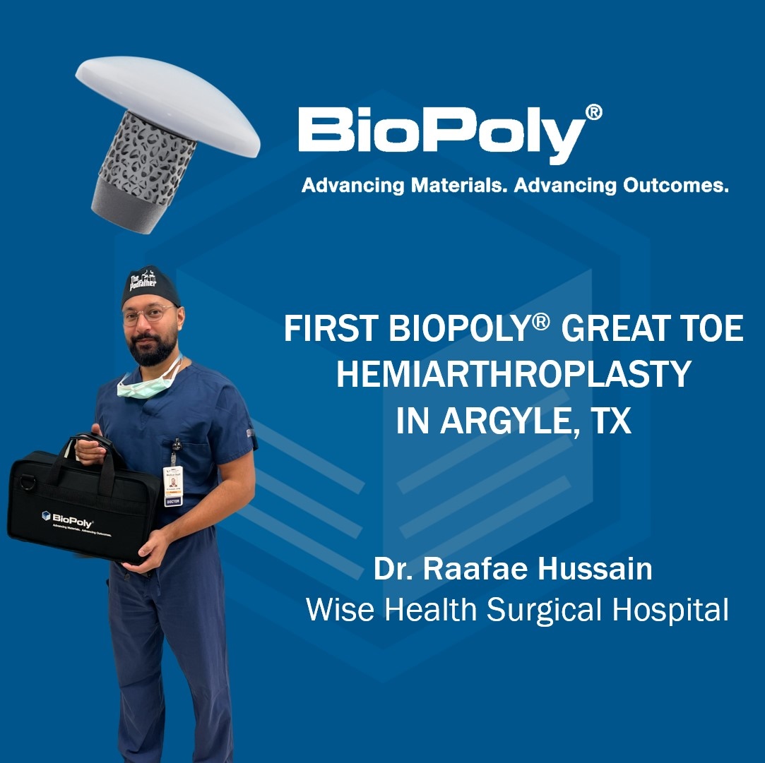BioPolyOrtho's tweet photo. Congrats to Dr. Raafae Hussain for implanting the first BioPoly Great Toe in Argyle, TX @ Wise Health Surgical Hospital! 👏

We are excited to see Texas continue to take off! 🚀

#biopoly #greattoe #texas #footandankle #firstcase #toe #syntheticcartilage #porousfixation https://t.co/VqEXb2RruU