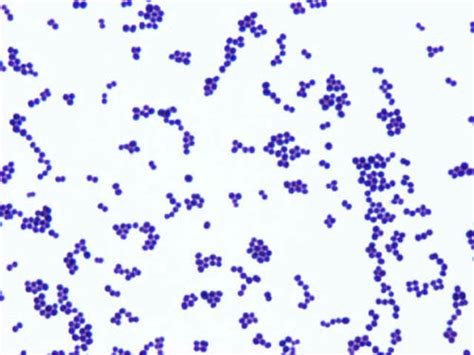 Luke Turner 🦠 (@microlukas) on Twitter photo Wondering how beta-lactam resistance occurs in Staphylococcus aureus (e.g. MRSA)?
A short đź§µ on the two most common mechanisms of beta-lactam resistance in S. aureus ... Wondering how beta-lactam resistance occurs in Staphylococcus aureus (e.g. MRSA)?
A short đź§µ on the two most common mechanisms of beta-lactam resistance in S. aureus ...