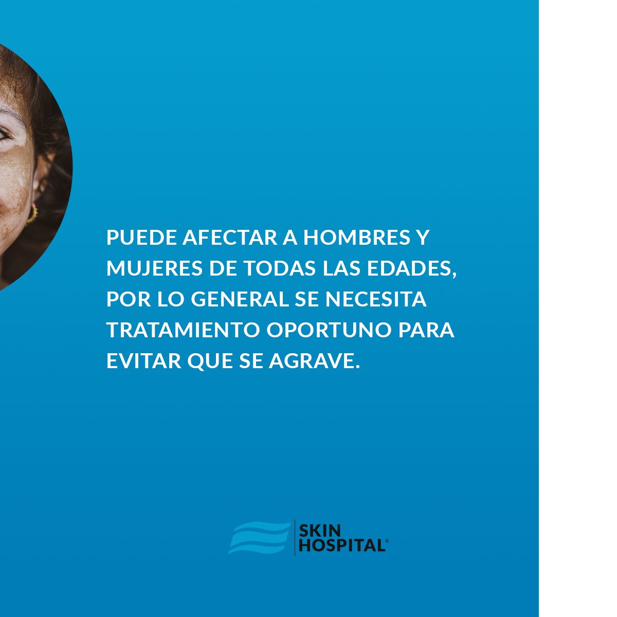SkinHospital_mx's tweet photo. #vitiligo
Trastorno #despigmentante de la piel que se manifiesta como manchas blancas en la #piel.

-LOOK GOOD &amp; FEEL GOOD- https://t.co/ZkihqVTc40