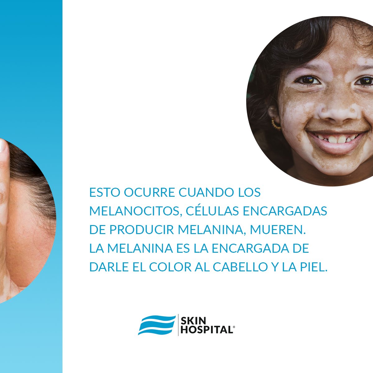 SkinHospital_mx's tweet photo. #vitiligo
Trastorno #despigmentante de la piel que se manifiesta como manchas blancas en la #piel.

-LOOK GOOD &amp; FEEL GOOD- https://t.co/ZkihqVTc40