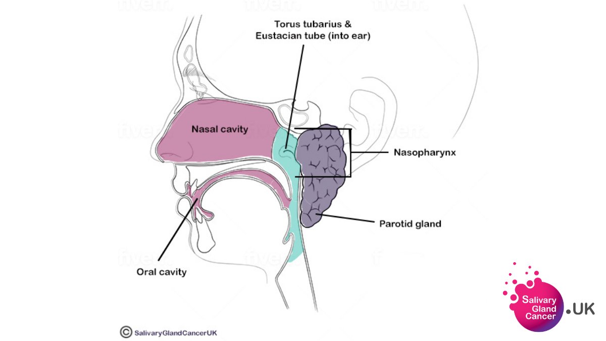 What are salivary gland cancers? Salivary Gland Cancer UK
