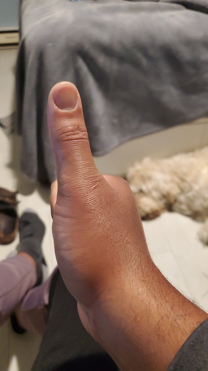 1BigSoda's tweet photo. @ian_mendes @saucyrockets Side note, dont have to go too far in your feed to you saying white people this, white people that. I dont understand how racism warriors can attack something you feel has hints of racism when you clearly have a disdain for a certain race. This is my hand, check the colour 🥱👍🏽 https://t.co/Ll3g4o8Xk1