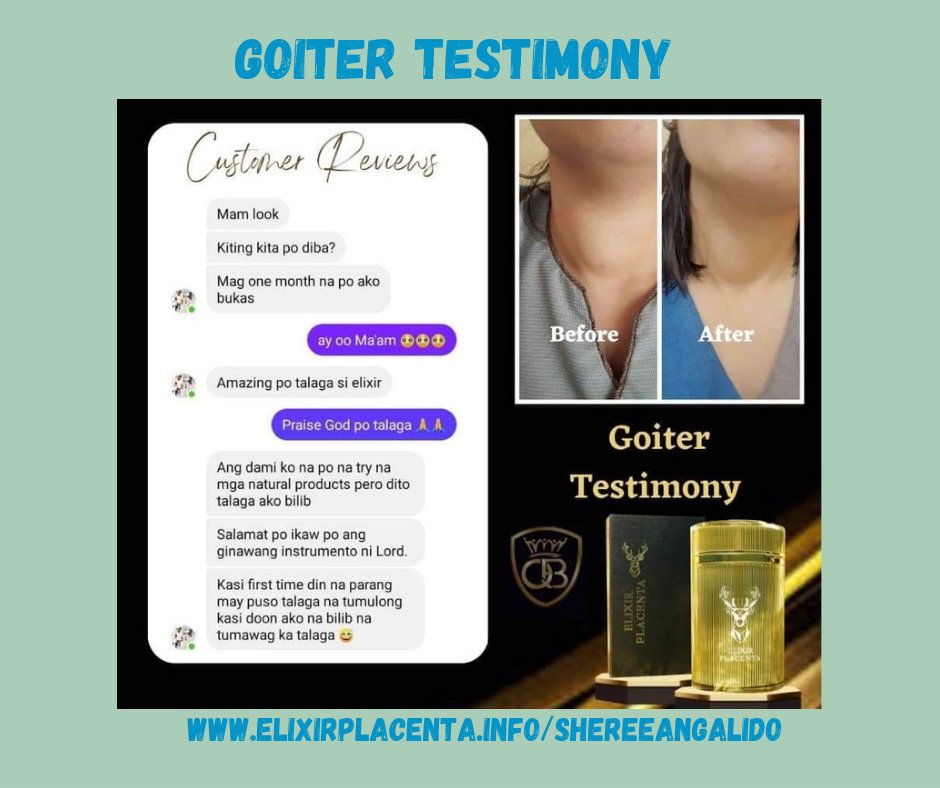 'REAL PEOPLE❗️REAL RESULTSI Just look at this amazing transformation! After a month of using Elixir Placenta, this customer's goiter has visibly reduced.Our product is natural and highly effective, repairing & regenerating damaged  cells elixirplacenta.info/shereeangalido
#stemcelltheraphy