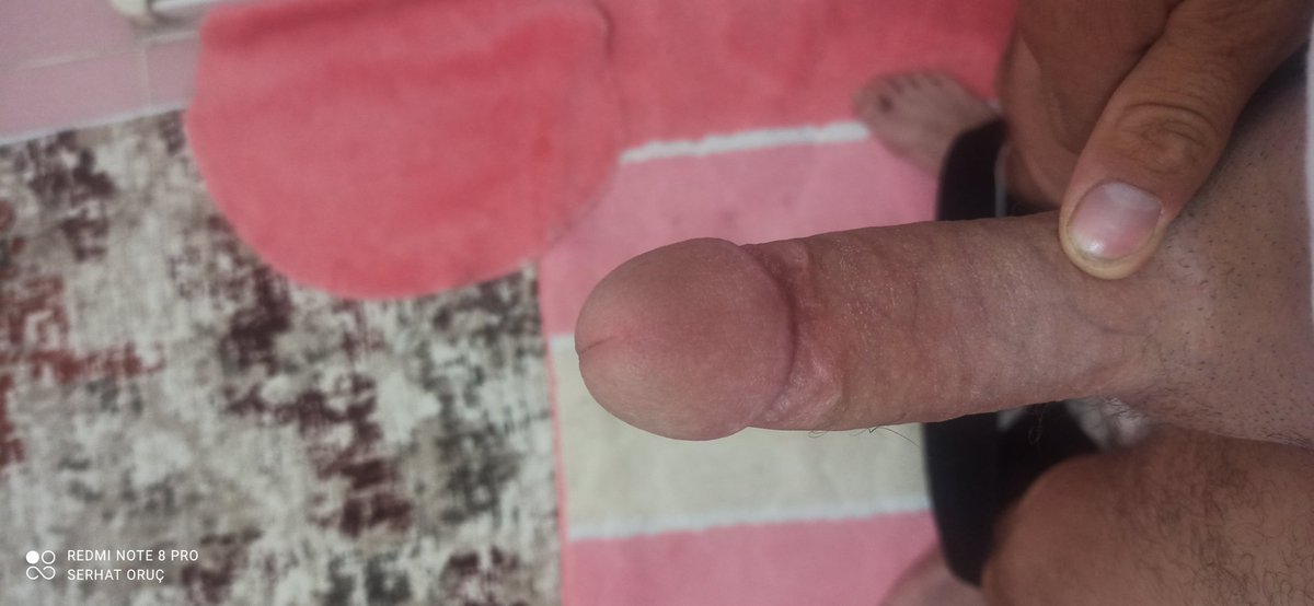 Yalamak isteyen varmı