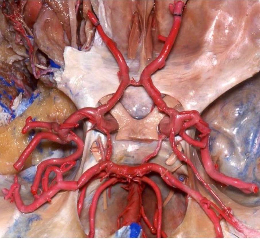 BrownJHM's tweet photo. Circle of Willis (medicaltalks) #Medtwitter https://t.co/lKMNZkEATu