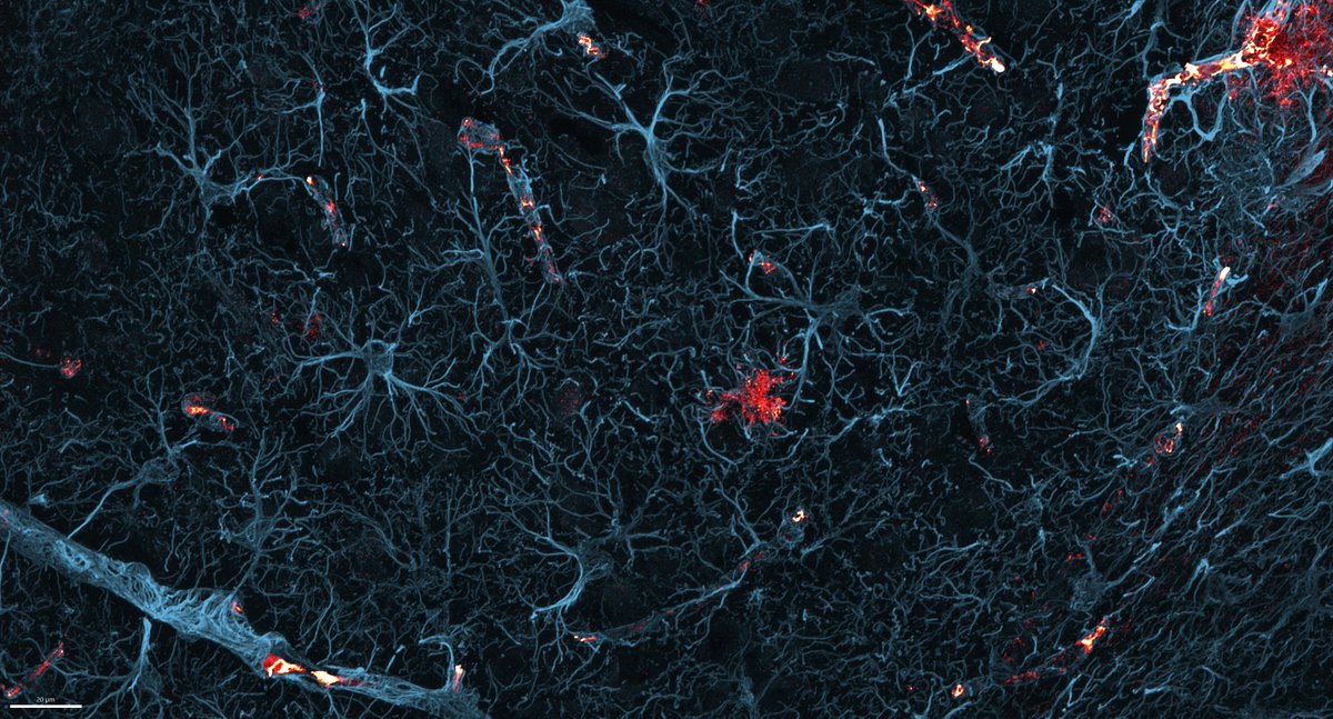 Michael Nesbit (@mlnesbit) on Twitter photo #FluorescenceFriday Astrocytes and Amyloid in young APP mouse. 60x <a href="/NikonInst/">Nikon Instruments</a> lens, <a href="/AndorTechnology/">Oxford Instruments Andor</a> Dragonfly502 @CHIRI_curtin #FluorescenceFriday Astrocytes and Amyloid in young APP mouse. 60x <a href="/NikonInst/">Nikon Instruments</a> lens, <a href="/AndorTechnology/">Oxford Instruments Andor</a> Dragonfly502 @CHIRI_curtin
