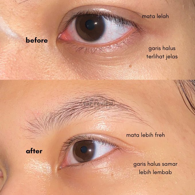 heybogosipeo's tweet photo. Pliss siapa setuju Lacoco Intensive Eye Serum ini oke banget buat samarin kerutan bawah mata? ✋🏻

Packagingnya juga juara, nyaman gak pilling, btw kalo mau cobain BURUAN CO mumpung Lacoco lagi diskon dari 200an jadi 80K aja🫠🫠

#racuninskincare https://t.co/LPHzTRFbCe
