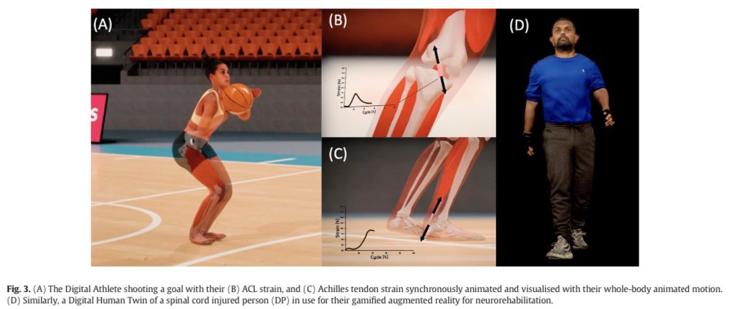 MBourne5's tweet photo. Real-time biofeedback of internal tissue loading in the field may inform individualised training for performance and rehabilitation 💪

Congratulations to all involved #GCORE @Griffith_Uni 

https://t.co/1pTAsMJnx5 https://t.co/CMVekws6gX
