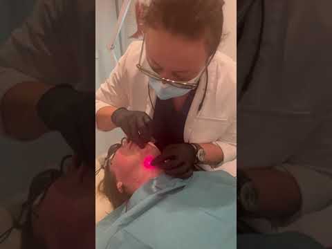 Endolift Laser Treatment: The Non-Surgical Facelift