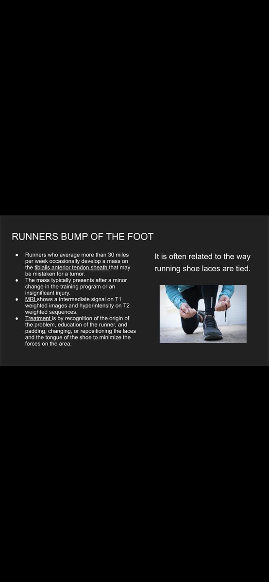Runners bump of the foot, a slowly growing mass in the tibials anterior tendon in runners

#runnersbump #runners #MRI #US #ultrasound #mskradiology #sportsradiology