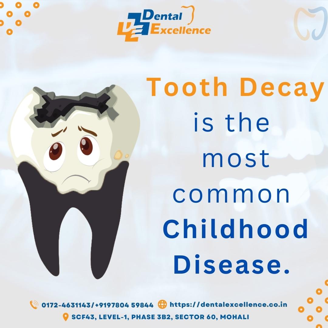 dentalexcelle17's tweet image. 🦷Tooth decay can occur when acid is produced from plaque, which builds up on your teeth. You need to take care of your teeth by visiting a good dentist regularly.

🌐Visit At- dentalexcellence.co.in

#ToothDecayTreatment #toothdecay #teethproblem #teethcare #teethcleaning