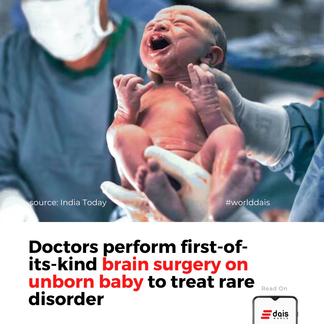 Brain surgery performed on unborn child.

For more, link on bio.
.
.
#sciencefacts #doctors #brainsurgery #UnbornBaby #miraclebaby #worlddais #BuddhaPurnima #FridayMotivation