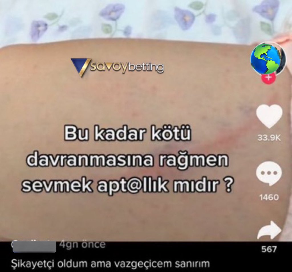 absurtolaylar's tweet photo. korkunç https://t.co/SZH4IpUc5i