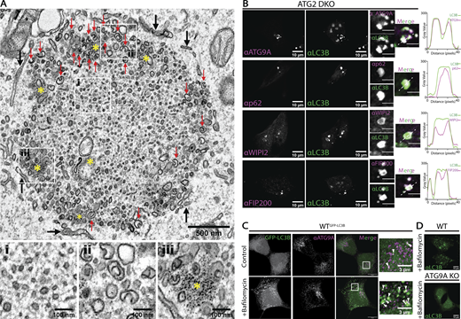 Journal of Cell Biology (@jcellbiol) on Twitter photo ATG9 vesicles comprise the seed membrane of mammalian autophagosomes, say Taryn J. Olivas <a href="/tjolivas/">Taryn Olivas</a>, Yumei Wu, Shenliang Yu <a href="/shenliang_yu/">Shenliang Yu, PhD</a>, Thomas Melia <a href="/TJ_MeliaLab/">Melia Lab</a> et al. <a href="/YaleCellBio/">Yale Cell Biology</a> bit.ly/3LBlFg4
<a href="/PDClab/">De Camilli Lab</a>
<a href="/GuptaLab1/">Kallol Gupta</a>
<a href="/1in_1uan/">Lin_Luan</a>
<a href="/em_guinn/">Emily</a>
<a href="/ShantaNag1/">Shanta Nag</a>
#autophagy ATG9 vesicles comprise the seed membrane of mammalian autophagosomes, say Taryn J. Olivas <a href="/tjolivas/">Taryn Olivas</a>, Yumei Wu, Shenliang Yu <a href="/shenliang_yu/">Shenliang Yu, PhD</a>, Thomas Melia <a href="/TJ_MeliaLab/">Melia Lab</a> et al. <a href="/YaleCellBio/">Yale Cell Biology</a> bit.ly/3LBlFg4
<a href="/PDClab/">De Camilli Lab</a>
<a href="/GuptaLab1/">Kallol Gupta</a>
<a href="/1in_1uan/">Lin_Luan</a>
<a href="/em_guinn/">Emily</a>
<a href="/ShantaNag1/">Shanta Nag</a>
#autophagy