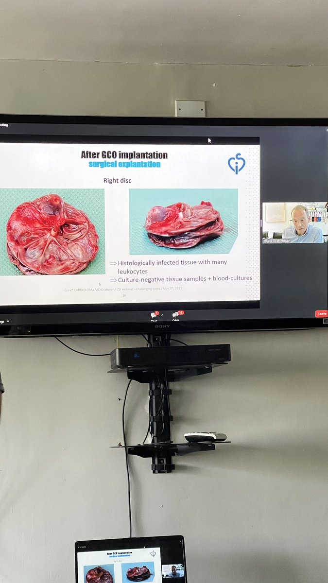 CARDIOKIDZ's tweet photo. Caso complejo 😰😰😰
Excelente ! 

@CSIcongress 

#CSIvirtual https://t.co/BNNu6vTOou