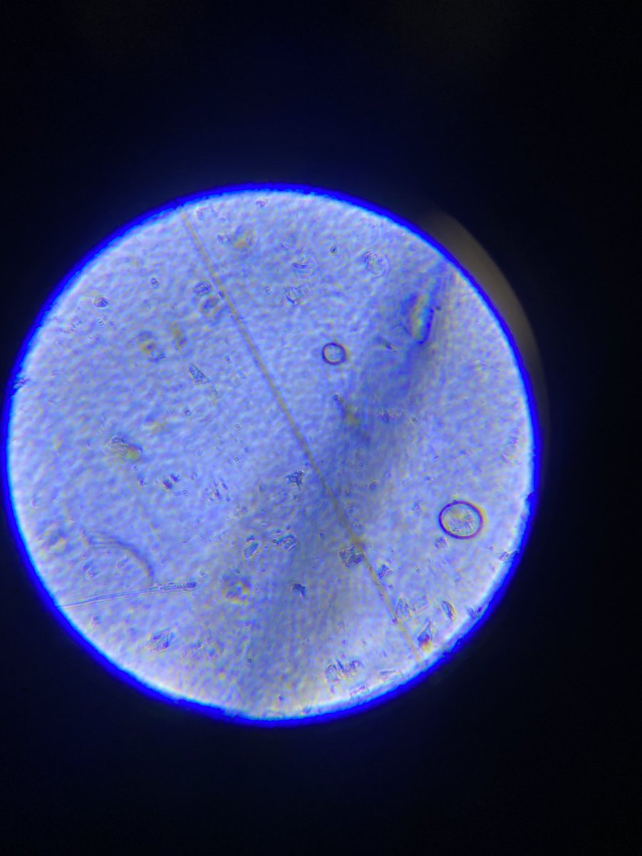 CamiBe90's tweet photo. Surprise what 25 euros can do.. I need to figure it out better and maybe not ideal on a moving boat .. #portablemicroscope #marinawater https://t.co/f2yIlciNtk