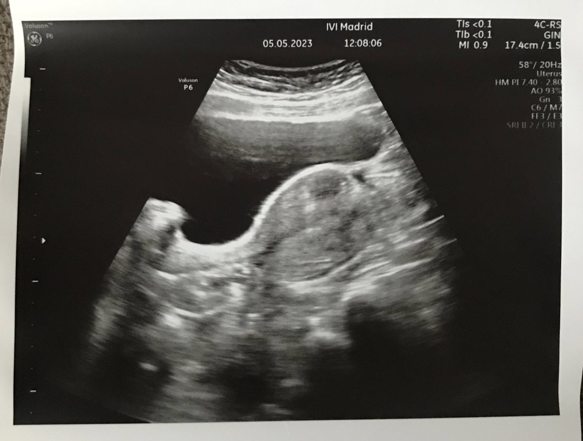 Oficialmente en beta espera!! Ya volvemos uno más en el coche 🤞🍀🌈😍❤️