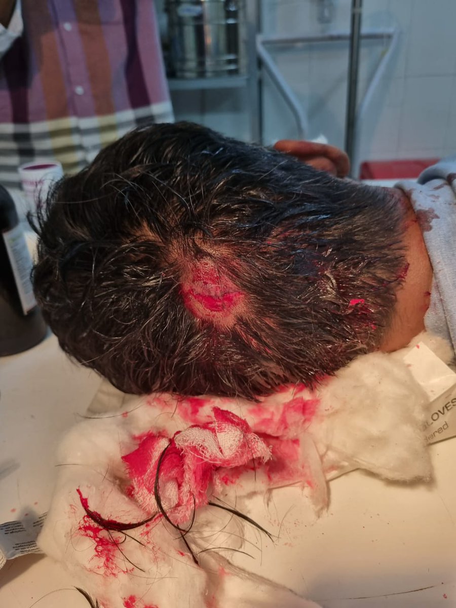 Horrible! Just informed that yesterday night, at around 4 am, one resident doctor (Obs &amp; Gynae) was attacked... He is posted at Dhailai diatrict under government's newly introduced DRP curriculum.

Who is responsible for the security of doctors when sent for District rotation???