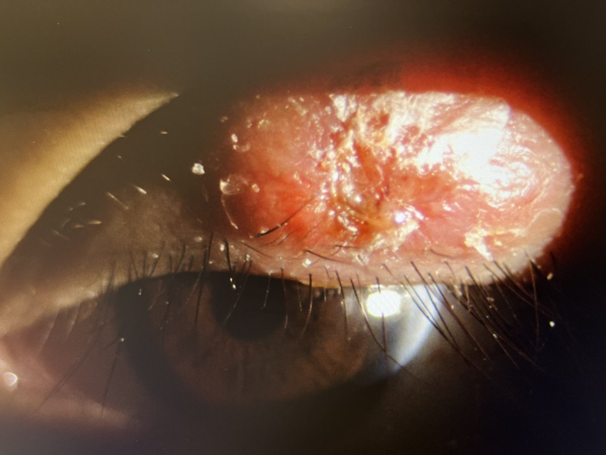 Cornelius LOW コーニリアス ロー 🛎🤼 tweet media