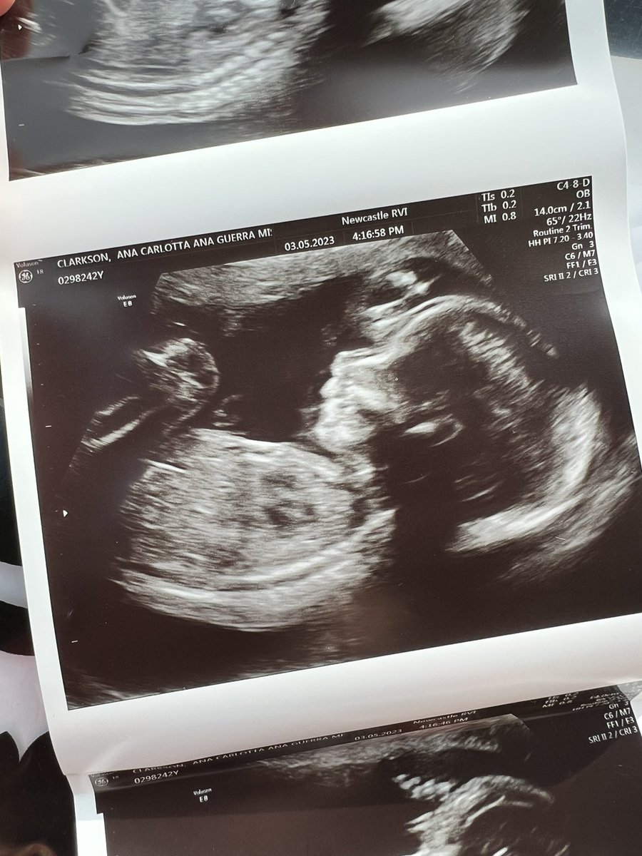 We’re having… a girly! 💖