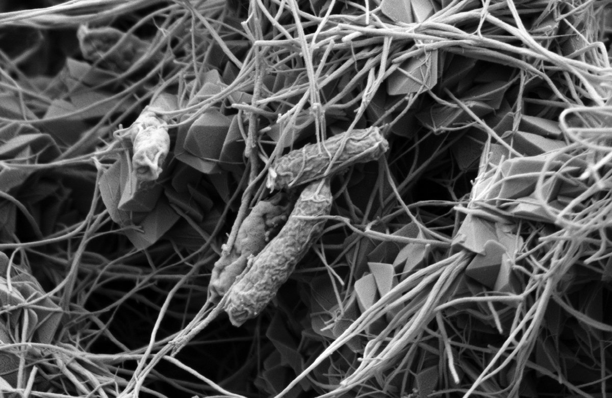 Jeremiah (Jer) Shuster (@jeremiahshuster) on Twitter photo Today's micrograph: A sample provided by Yu Pei. Here, we have cells of Acidithiobacillus ferrooxidans amongst two different #minerals. The minerals are likely schwertmannite and jarosite.
Fun #SEM times in the @TSM_UniTue and <a href="/GeomicroTueb/">Tuebingen Geomicrobiology</a>. Today's micrograph: A sample provided by Yu Pei. Here, we have cells of Acidithiobacillus ferrooxidans amongst two different #minerals. The minerals are likely schwertmannite and jarosite.
Fun #SEM times in the @TSM_UniTue and <a href="/GeomicroTueb/">Tuebingen Geomicrobiology</a>.