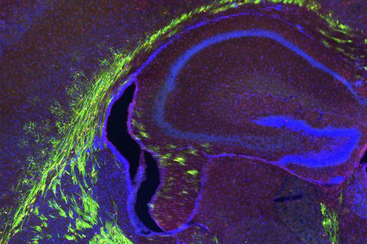 Unique Omega-3 Fatty Acid Lipid Could Revolutionize Our Understanding of Brain Development and Aging

Researchers discover a protein that regulates brain cells responsible for myelin sheaths and could help reduce damage from aging. Omega-3 lipids play a crucial role in brain