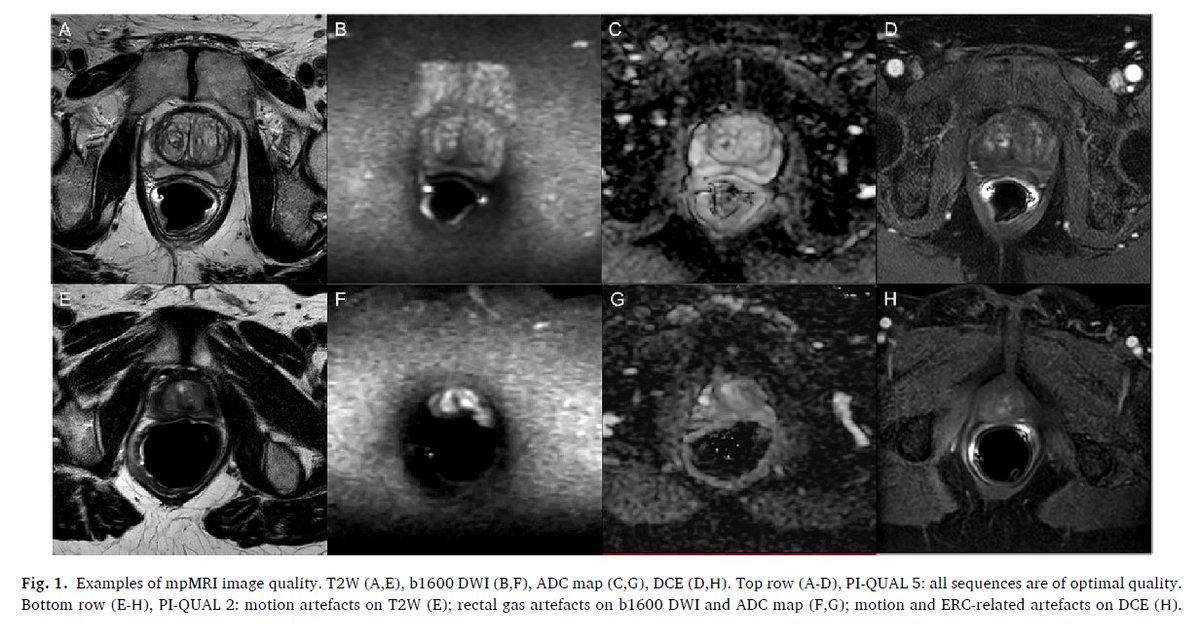 Baris Turkbey MD tweet media