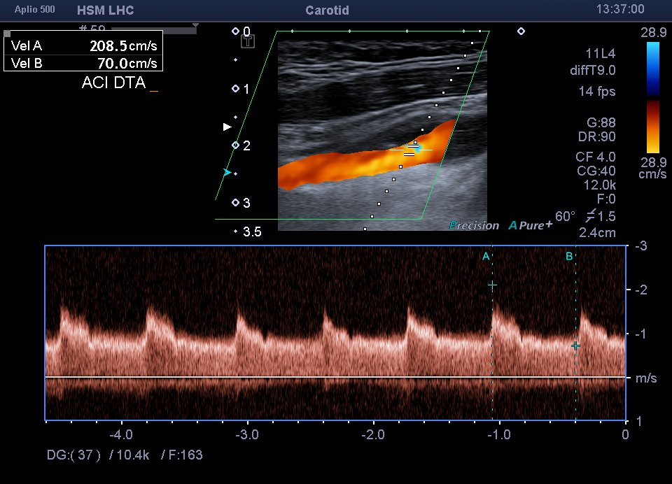 Neurosonology Lab - LHC tweet media