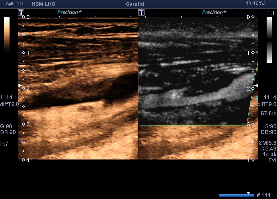 Neurosonology Lab - LHC tweet media
