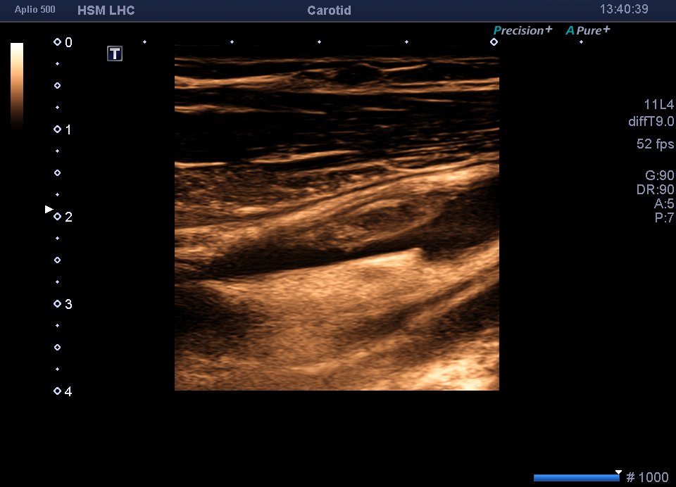 Neurosonology Lab - LHC tweet media