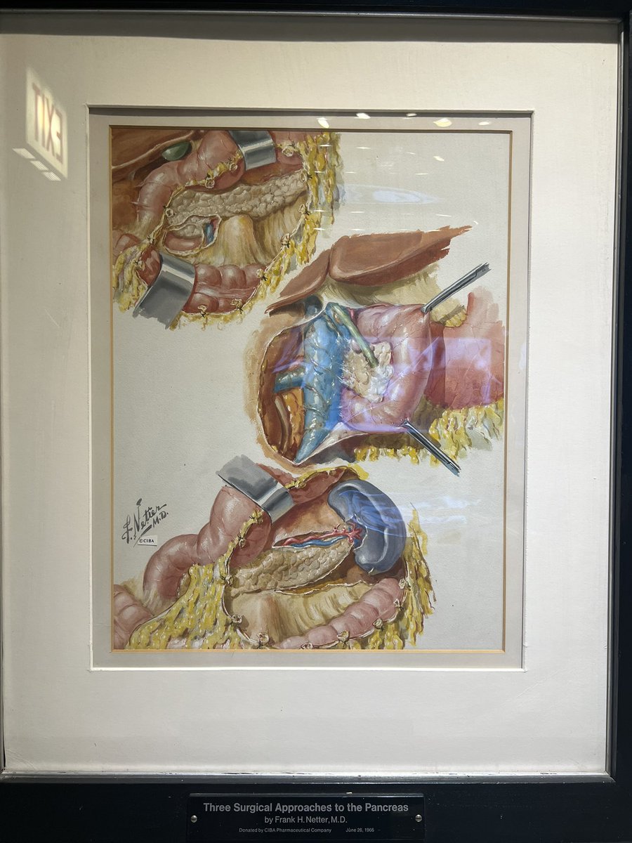 Flavio G Rocha, MD, FACS, FSSO (@flaviorochamd) on Twitter photo Three approaches to the pancreas by Frank Netter, MD; very appropriate for <a href="/PancreasClub/">The Pancreas Club</a> #PancreasClub2023 Three approaches to the pancreas by Frank Netter, MD; very appropriate for <a href="/PancreasClub/">The Pancreas Club</a> #PancreasClub2023