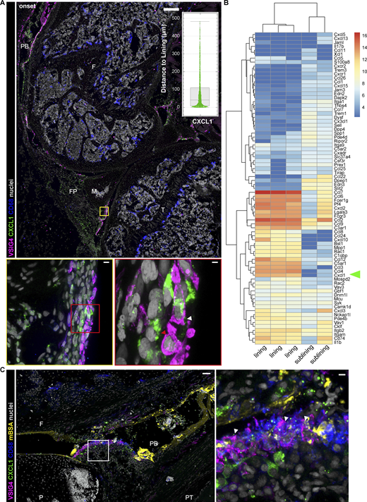 #Macrophages in the synovial lining niche initiate #neutrophil recruitment and articular #inflammation, say Kristina Zec, Irina Udalova et al. <a href="/UdalovaLab/">Udalova Lab - Genomics of Inflammation</a> <a href="/KirOxford/">Kennedy Institute of Rheumatology</a> bit.ly/3LD9qzx
#arthritis