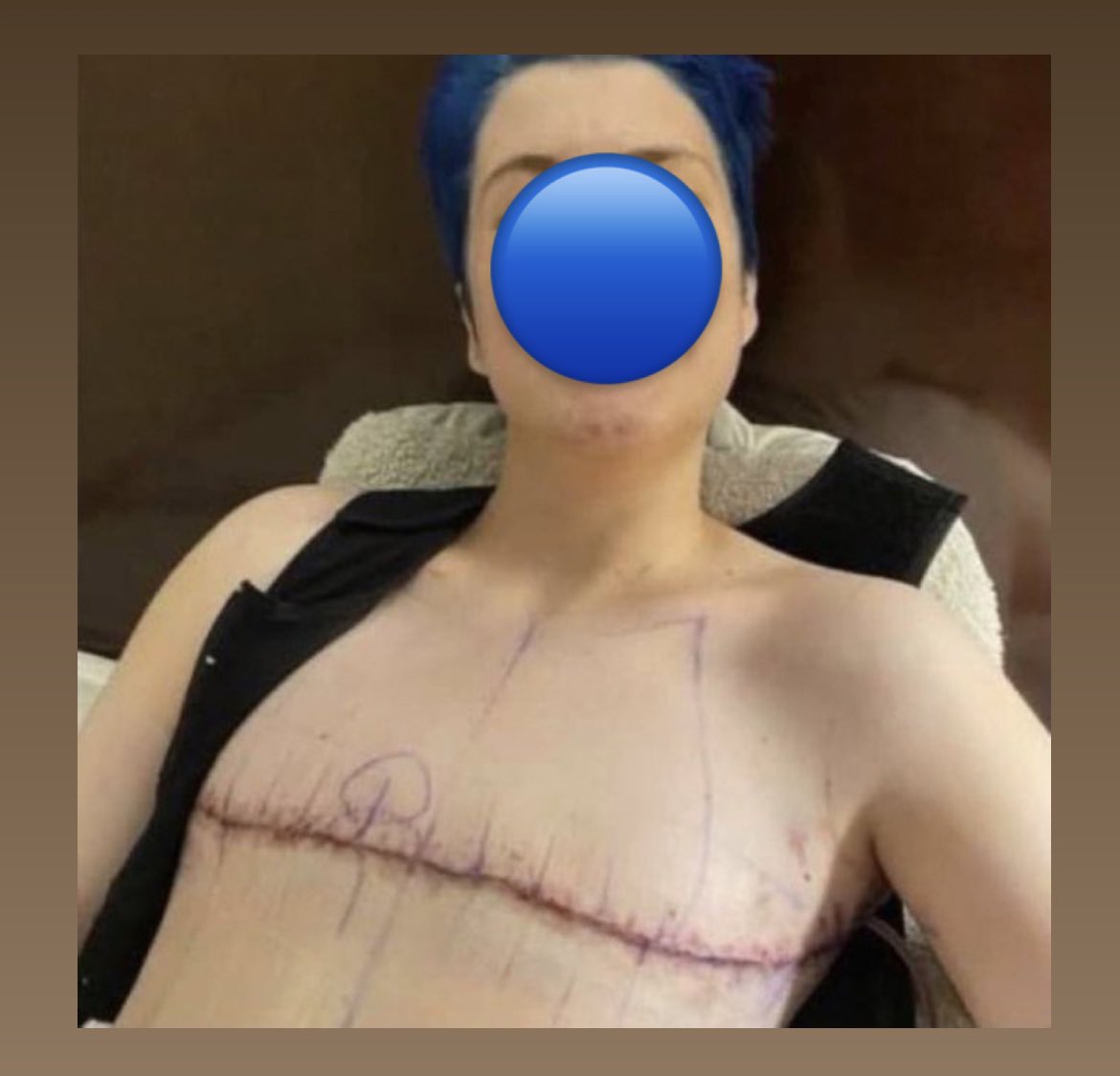 LucyRiles's tweet photo. No one. Absolutely NO ONE can convince me that cutting off perfectly healthy breast tissue in minors is not child abuse.
This is not “gender affirming” this is CHILD ABUSE by preying on malleable, vulnerable young minds for medical profit.
What ever happened to promoting self love and body positivity?!? Oh wait…big pharma can’t profit off that..
