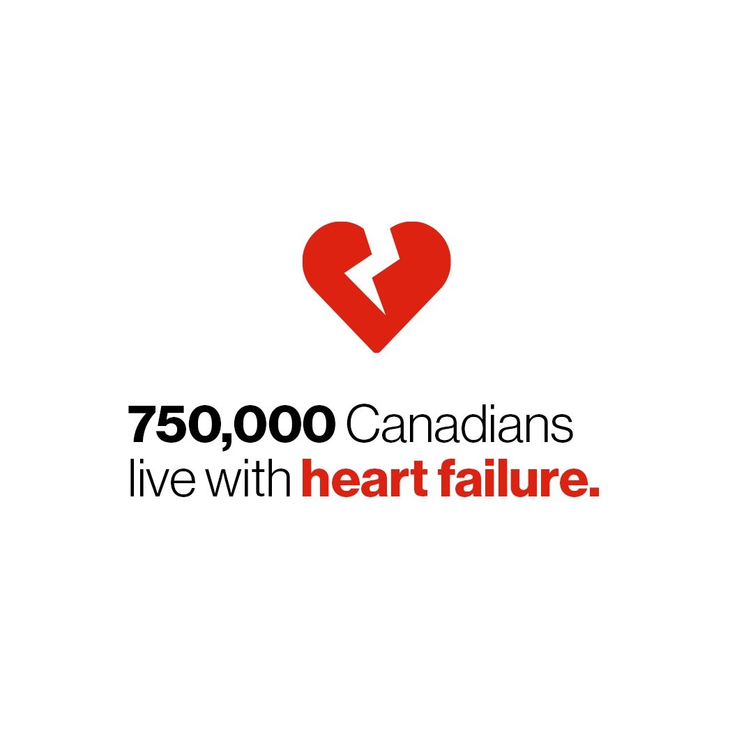 Heart failure is a chronic condition caused by the heart not functioning as it should or a problem with its structure. It is estimated that about 750,000 Canadians are living with heart failure. #HeartFailureWeekCan #BeatHeartDisease