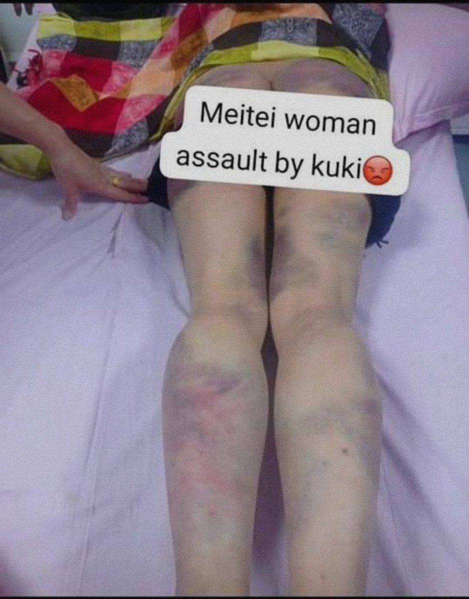 ahanthemx's tweet photo. 6 Hindu #Meitei students are being raped by the #Kuki terrorist group but the DGP P Doungel denied these news. Does he even have heart or any sympathy? #ManipurViolence #ManipurOnFire #manipurisburning #savemeitei #SaveManipuriHindus #savemanipuri #manipurnews #Manipur #imphal https://t.co/qf4BWzEvr5
