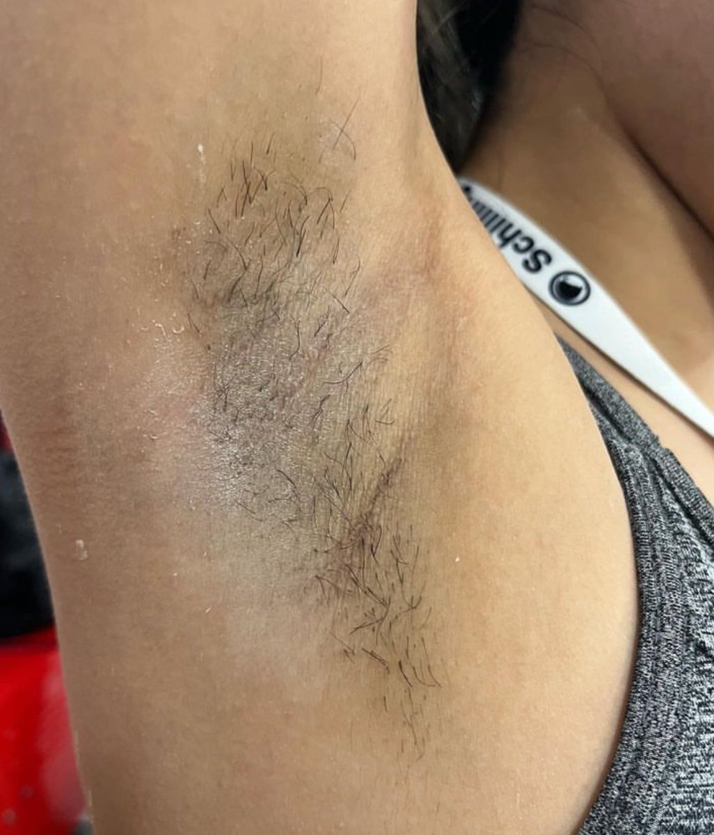 skinwithdaisy's tweet photo. absolute fav of mine i love doing underarm waxes! this one is on miss jeidy 🤩 book your appointment now! https://t.co/ZbtaOgnRub