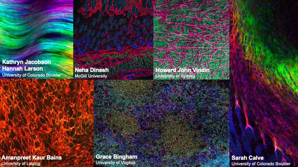 Congratulations to the 2023 ASMB Image Contest Winners!

Learn more about the images: asmb.net/image-contest-…