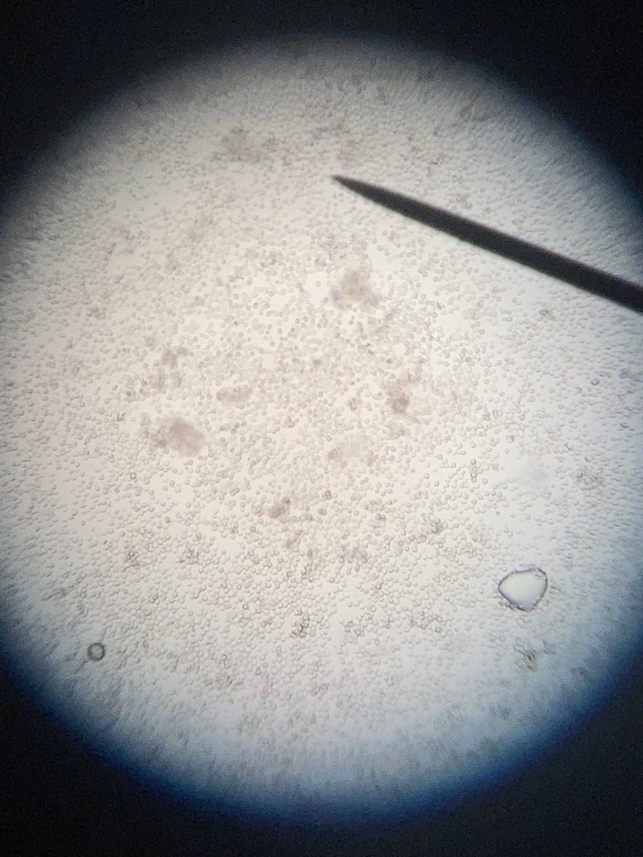 MsMatthewBio's tweet image. S3 biologists started their Biotechnology topic with a look at some yeast today!