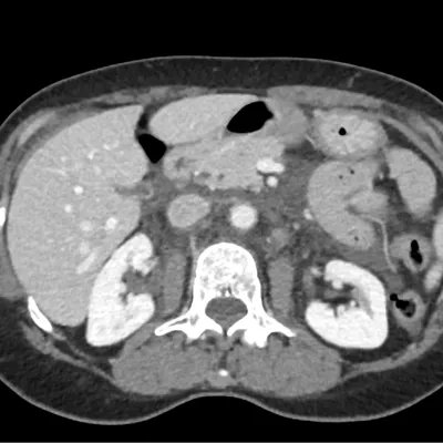 AuntMinnie.com tweet media