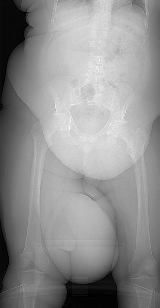 CASE 128 ⬇️⬇️⬇️ Worsening mass and swelling Diagnosis? Answer will be posted on Friday, 5/12. #MSKRad #RadRes #RadFellows