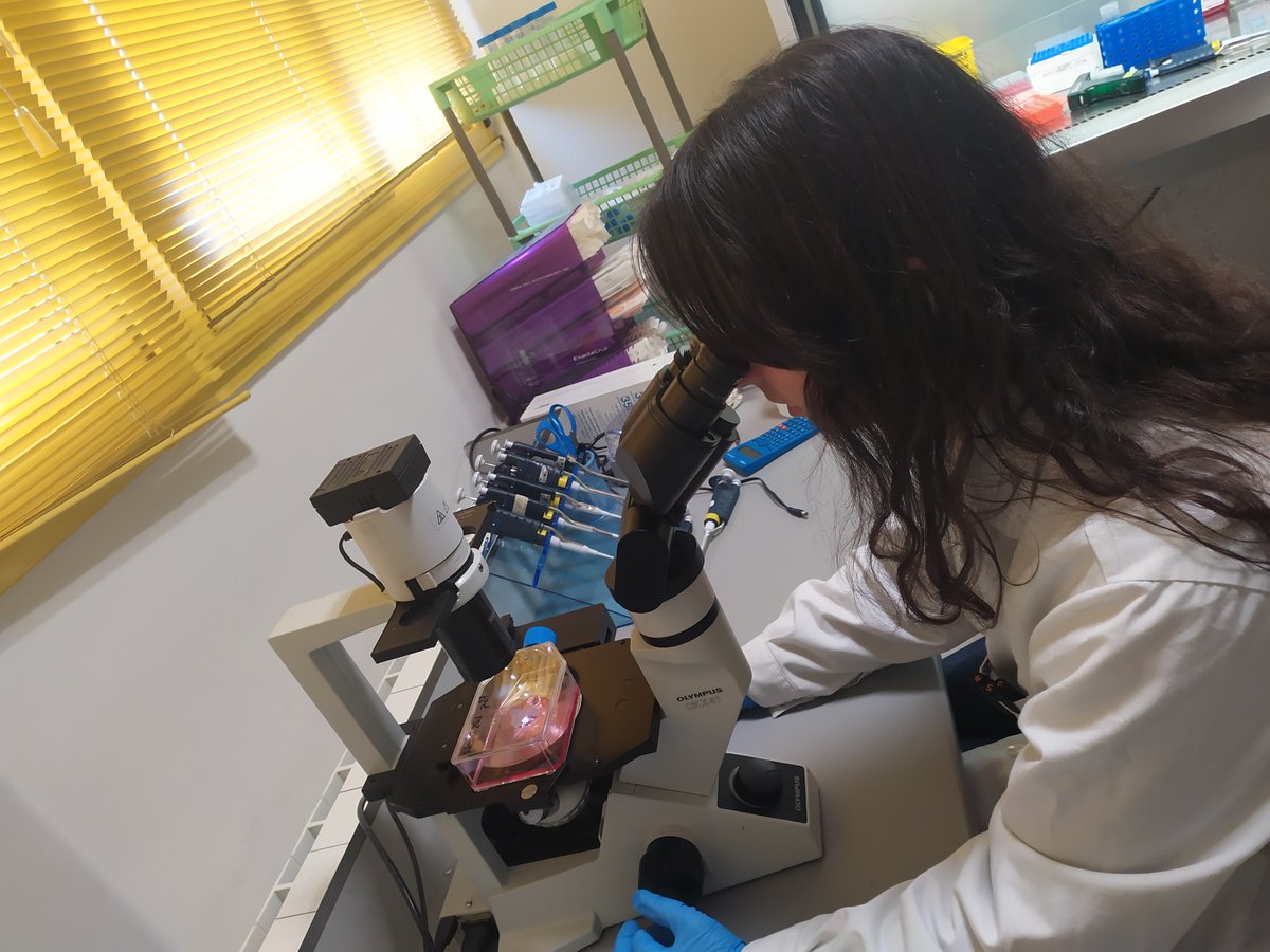 pauu_78's tweet photo. Las células de hepatocarcinoma han sido mis fieles compañeras🫂durante toda la tesis, permitiendo:👇
1- Identificar mecanismos moleculares implicados en la progresión tumoral y resistencia a fármacos.
2- Identificar posibles dianas terapéuticas frente al hepatocarcinoma. https://t.co/HG94tp0DGI
