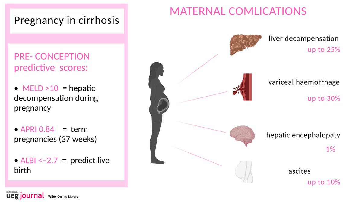 UEGJ (@uegjournal) on Twitter photo #UEGJFridays
📌 Management of pregnancy in women with cirrhosis
🔴 Complications
🪡 1/2
<a href="/joostphdrenth/">Joost PH Drenth</a> <a href="/omar_elshaarawy/">Omar Elshaarawy</a> <a href="/a_burez/">Anna Burelli</a> @AnaDugic <a href="/LumirKunovsky/">Lumír Kunovský</a> <a href="/AntheaPisani/">Anthea Pisani</a> <a href="/KM_Pawlak/">Katarzyna Monika Pawlak</a> <a href="/drkeithsiau/">Keith Siau</a>
#LiverTwitter #GITwitter
Read more 👇
onlinelibrary.wiley.com/doi/pdfdirect/… #UEGJFridays
📌 Management of pregnancy in women with cirrhosis
🔴 Complications
🪡 1/2
<a href="/joostphdrenth/">Joost PH Drenth</a> <a href="/omar_elshaarawy/">Omar Elshaarawy</a> <a href="/a_burez/">Anna Burelli</a> @AnaDugic <a href="/LumirKunovsky/">Lumír Kunovský</a> <a href="/AntheaPisani/">Anthea Pisani</a> <a href="/KM_Pawlak/">Katarzyna Monika Pawlak</a> <a href="/drkeithsiau/">Keith Siau</a>
#LiverTwitter #GITwitter
Read more 👇
onlinelibrary.wiley.com/doi/pdfdirect/…