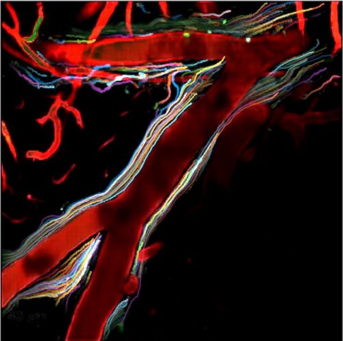 UofRBME's tweet photo. "Cerebrospinal fluid flows through wide perivascular spaces into the brain", from BME major Antonio Ladron de Guevara Ruiz ’24, placed 2nd in the @uofR's Art of Science competition. Congrats!
------>: https://t.co/ASvcTi8YaM 
#URBME #biomedicalengineering  #URochesterResearch https://t.co/RzPstq8c8W