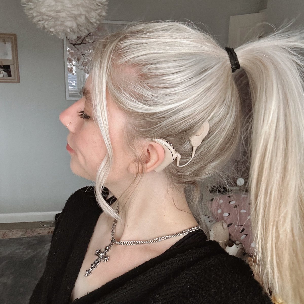 🤍 #deafawarenessweek 
my cochlear implants have gave me a new world and i’ll always be thankful, but it’s not a ‘fix’

i still struggle to hear, i get anxious in any social situation

i wouldn’t change anything about them but it’s something that needs to be spoken about more <3