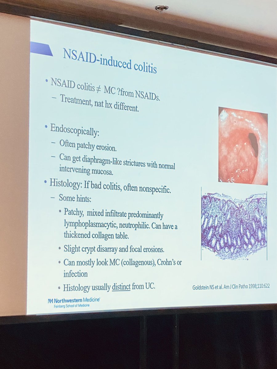 DCharabaty's tweet photo. #IBDMasterClass @NorthwesternDHF
NSAIDs-Colitis @EugeneYenMD
Don’t confuse it w #IBD or #MicroscopicColitis !
NSAIDs can cause
🔦Patchy erosion
🔦Diaphragmatic stricture
🔬Lymphocytes infiltrate
🔬Collagenous table
🔬Slight crypt disarray
What has been your experience? https://t.co/kpPCtUN0Wo